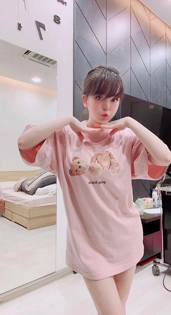 Phau thuat gan het khuôn mat các hotgirl mang xã hoi ngày ấy giờ thế nào - 10