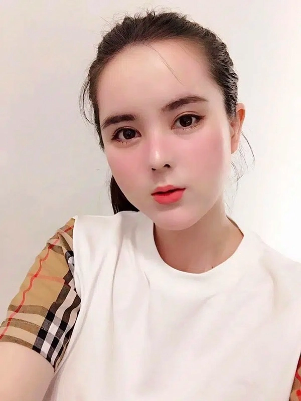 Phau thuat gan het khuôn mat các hotgirl mang xã hoi ngày ấy giờ thế nào - 12