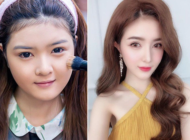 Phau thuat gan het khuôn mat các hotgirl mang xã hoi ngày ấy giờ thế nào - 14