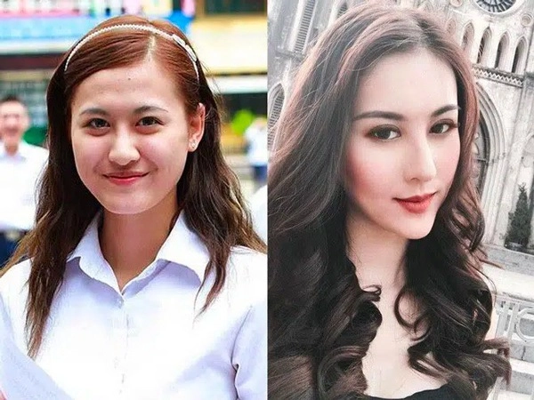Phau thuat gan het khuôn mat các hotgirl mang xã hoi ngày ấy giờ thế nào - 18