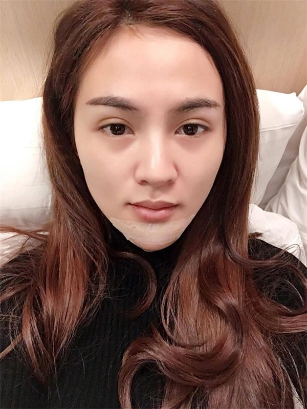 Phau thuat gan het khuôn mat các hotgirl mang xã hoi ngày ấy giờ thế nào - 24