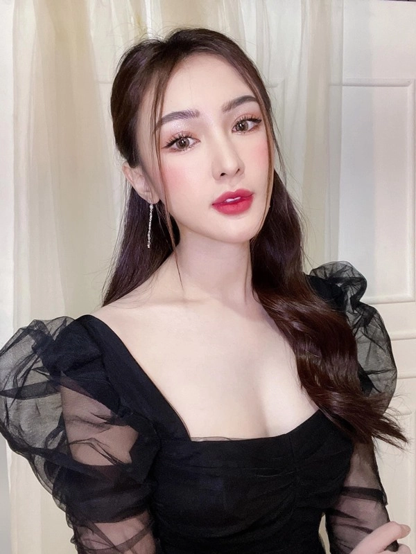 Phau thuat gan het khuôn mat các hotgirl mang xã hoi ngày ấy giờ thế nào - 26