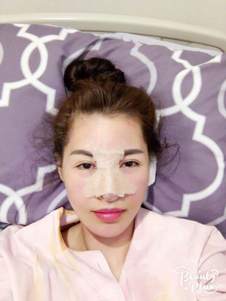 Phẫu thuật thẩm mỹ dày đặc hương giang tụt dốc sức khỏe lê giang khác lạ vẫn chưa muốn dừng - 24