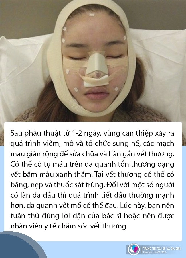 Phẫu thuật vùng mặt xong cần chăm sóc da và trang điểm thế nào để vừa xinh mà vẫn khoẻ - 2