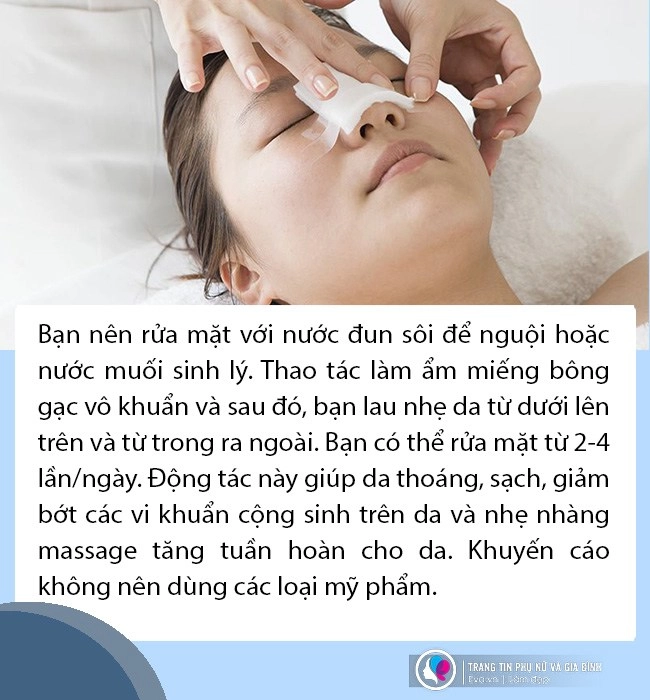 Phẫu thuật vùng mặt xong cần chăm sóc da và trang điểm thế nào để vừa xinh mà vẫn khoẻ - 3