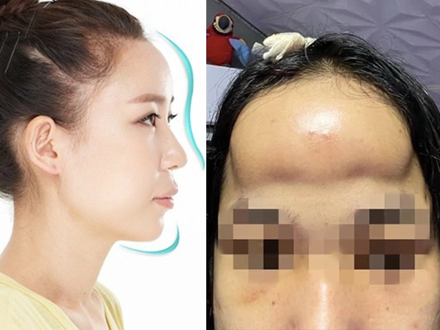 Phẫu thuật vùng mặt xong cần chăm sóc da và trang điểm thế nào để vừa xinh mà vẫn khoẻ - 12