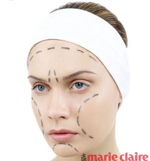 Phương pháp thẩm mỹ nào đáng tin cậy nhất - 6