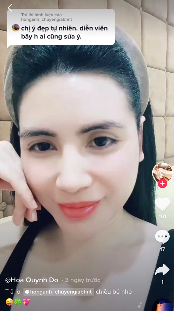 Quỳnh hoa tự bóp mũi chứng minh đẹp tự nhiên không phẫu thuật thẩm mỹ - 5