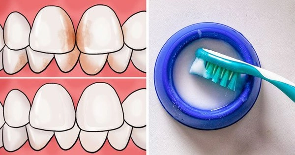 Răng bị ố vàng cứ áp dụng những cách này sẽ trắng sáng nhanh chóng - 1