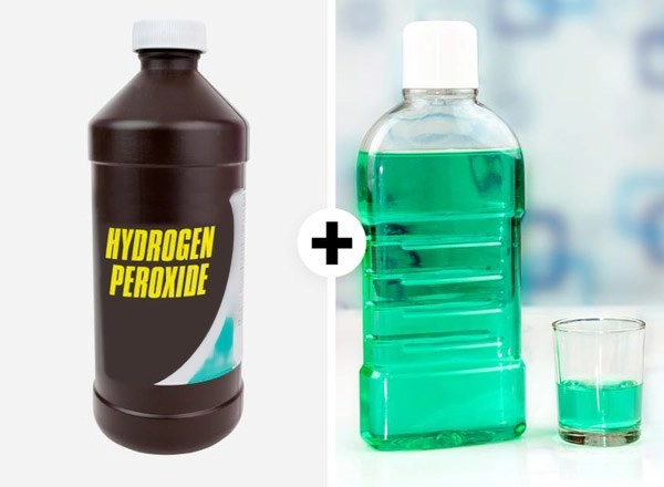 Răng bị ố vàng cứ áp dụng những cách này sẽ trắng sáng nhanh chóng - 5