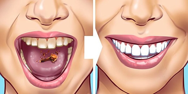 Răng bị ố vàng cứ áp dụng những cách này sẽ trắng sáng nhanh chóng - 9