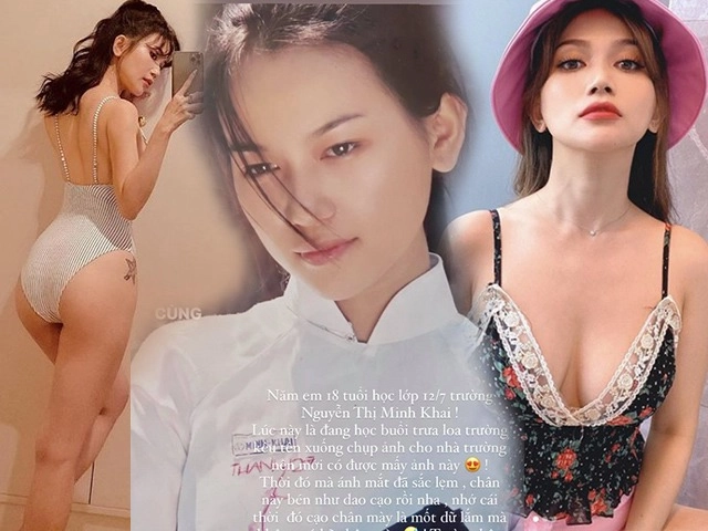 Rẻ-đẹp-dễ giãn cách chặn đứng shipper chị em tự tin cố thủ đánh bay mụn mủ với 3 món này - 14