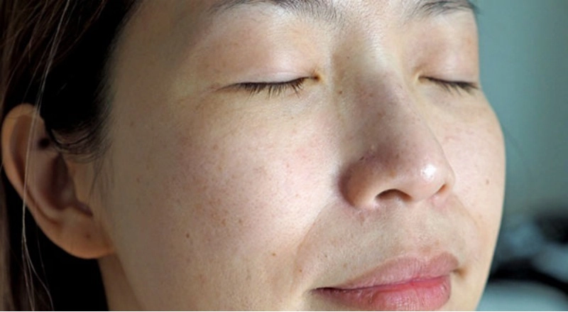 Rẻ-đẹp-dễ việt nam may mắn có 1 loại lá chuyên trị nám tìm đâu cũng có - 7