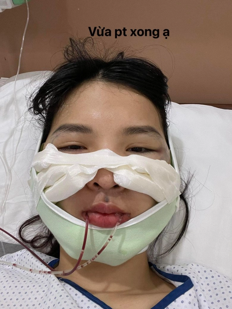 Rùng mình chiến tích gái xinh đem về hậu gọt hàm hạ gò má trượt cằm - 4