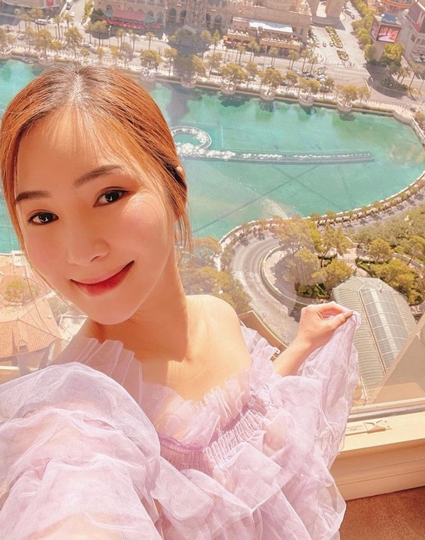 Sang mỹ nhưng nữ ca sĩ này vẫn bị réo gọi vì nghi vấn hậu dao kéo - 13