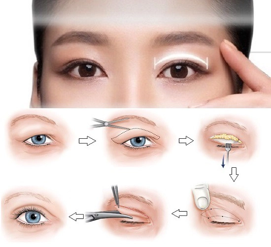 Sao cắt mí người được khen đẹp như phạm băng băng người quyến rũ trông thấy - 20
