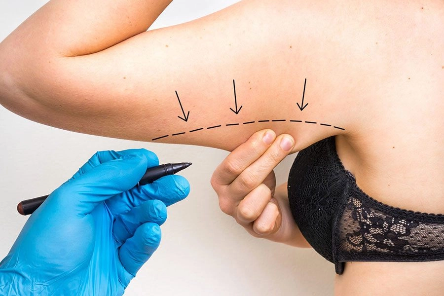 Sau khi thử phương pháp làm nhỏ bắp tay ngọc thanh tâm khuyên chị em không nên - 2