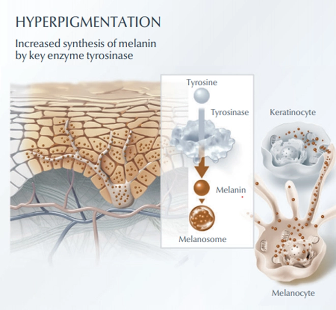 Serum giảm nám hiệu quả nhờ ức chế enzyme đứng đầu chuỗi sản sinh melanin - 1