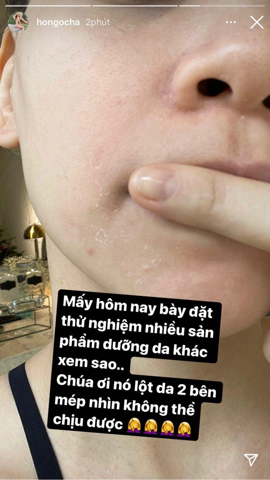 Mặt mộc mẹ bỉm vbiz song hà vừa sinh xong đã hồng hào bảo thy trắng như photoshop - 9