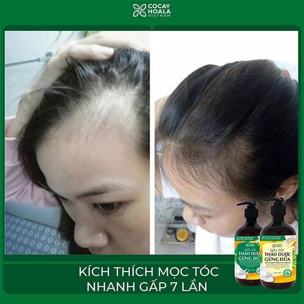 Sử dụng dầu gội gừng đúng cách để tóc mọc chắc khỏe sau 10 ngày - 6