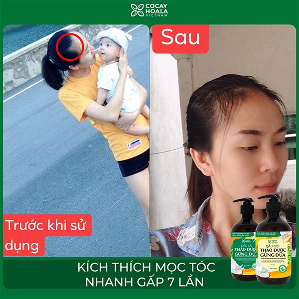 Sử dụng dầu gội gừng đúng cách để tóc mọc chắc khỏe sau 10 ngày - 7