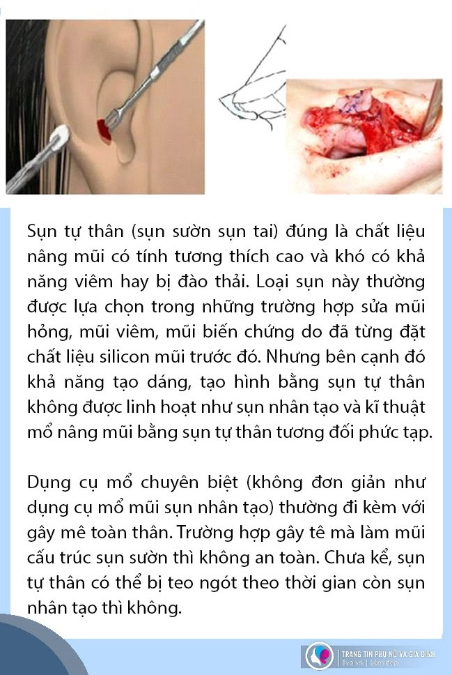 Sự thật không phải ai cũng tỏ nâng mũi quyết định chỉ 1 ở chất liệu - 2