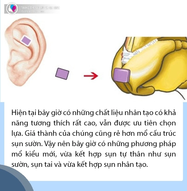Sự thật không phải ai cũng tỏ nâng mũi quyết định chỉ 1 ở chất liệu - 3