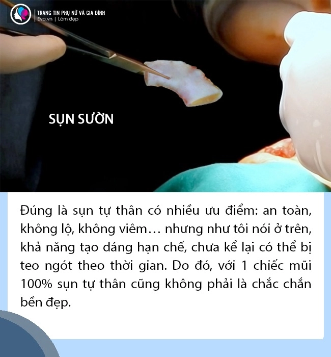 Sự thật không phải ai cũng tỏ nâng mũi quyết định chỉ 1 ở chất liệu - 5