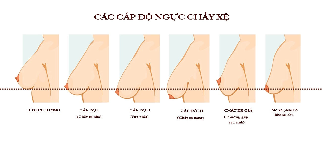 Tại sao nhiều chị em chọn lựa phương pháp làm đẹp này sau sinh - 2