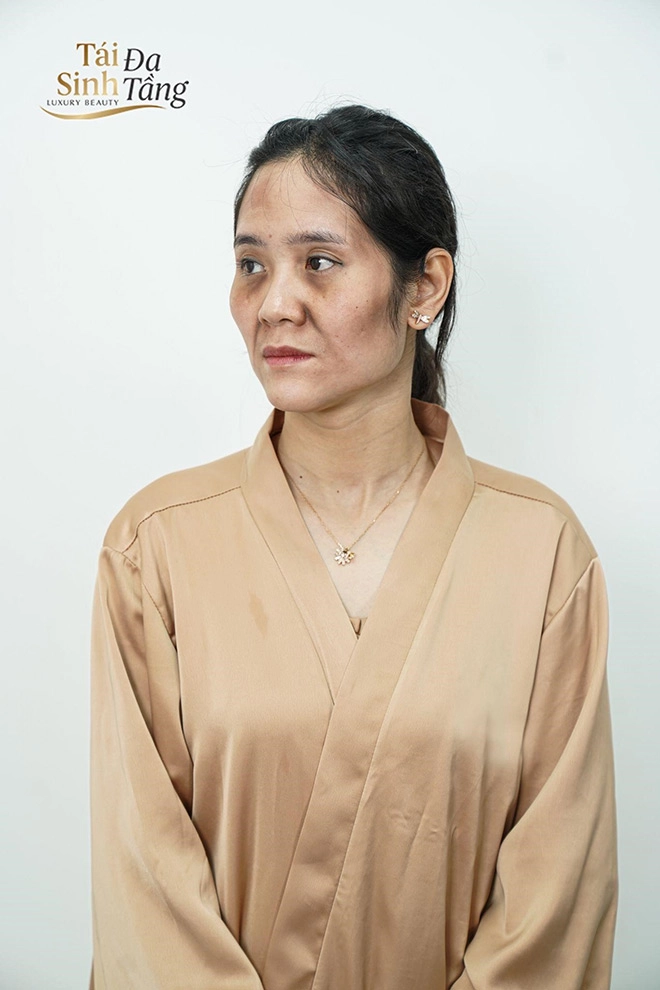 Tái sinh đa tầng đồng hành cùng bạn trên chặng đường làm đẹp chiến thắng thời gian và tuổi tác - 1