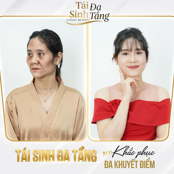 Tái sinh đa tầng đồng hành cùng bạn trên chặng đường làm đẹp chiến thắng thời gian và tuổi tác - 4