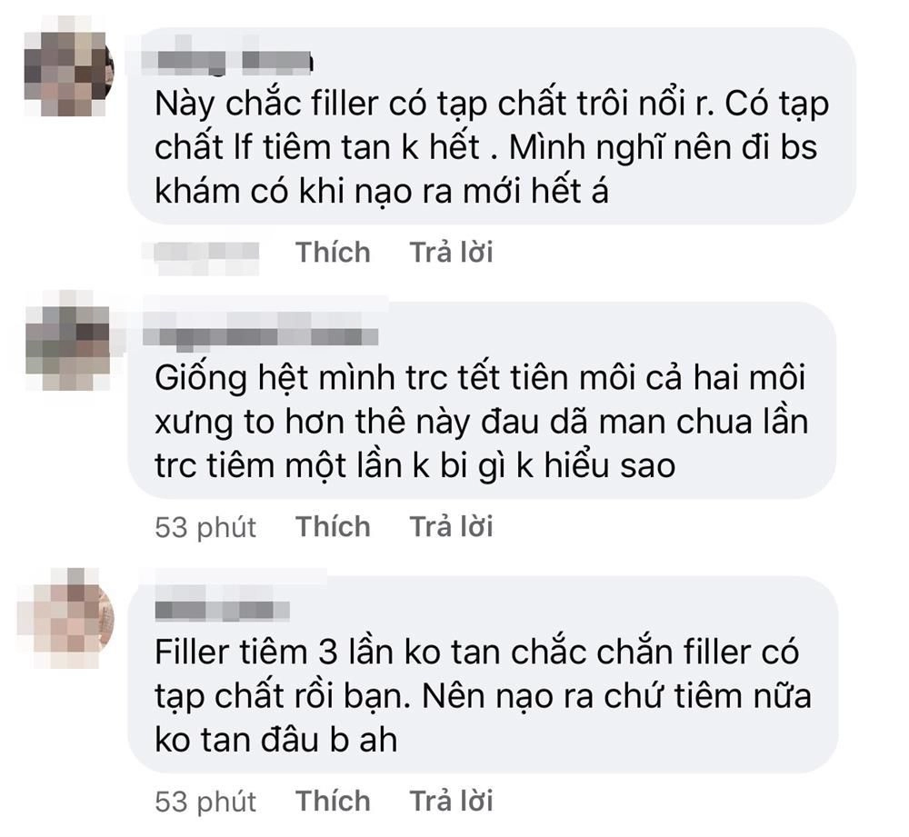 Tâm linh không dám đi cắt môi gái xinh mạnh dạn tiêm filler nhận ngay đôi môi hệt gái ngành - 6