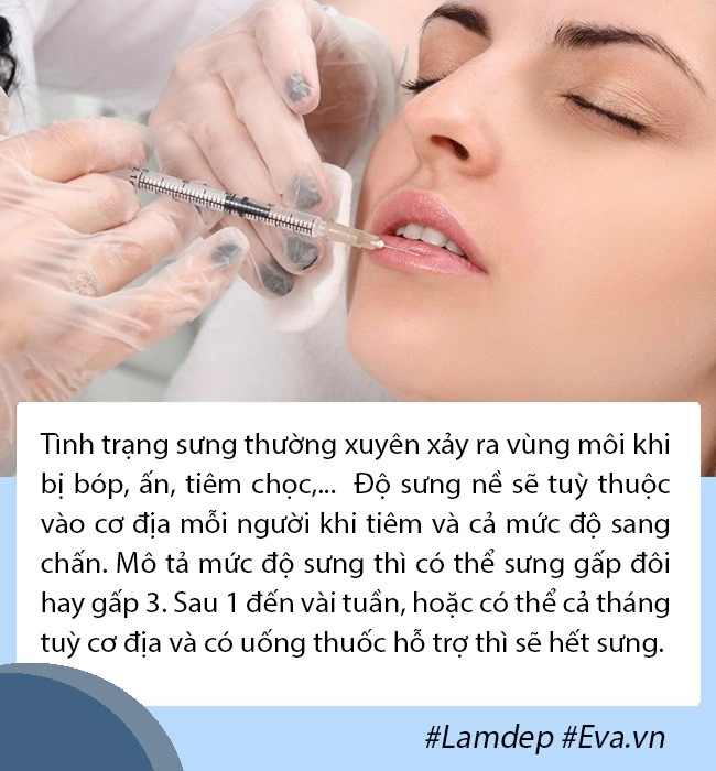 Tâm linh không dám đi cắt môi gái xinh mạnh dạn tiêm filler nhận ngay đôi môi hệt gái ngành - 7