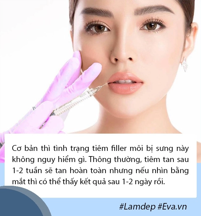 Tâm linh không dám đi cắt môi gái xinh mạnh dạn tiêm filler nhận ngay đôi môi hệt gái ngành - 8