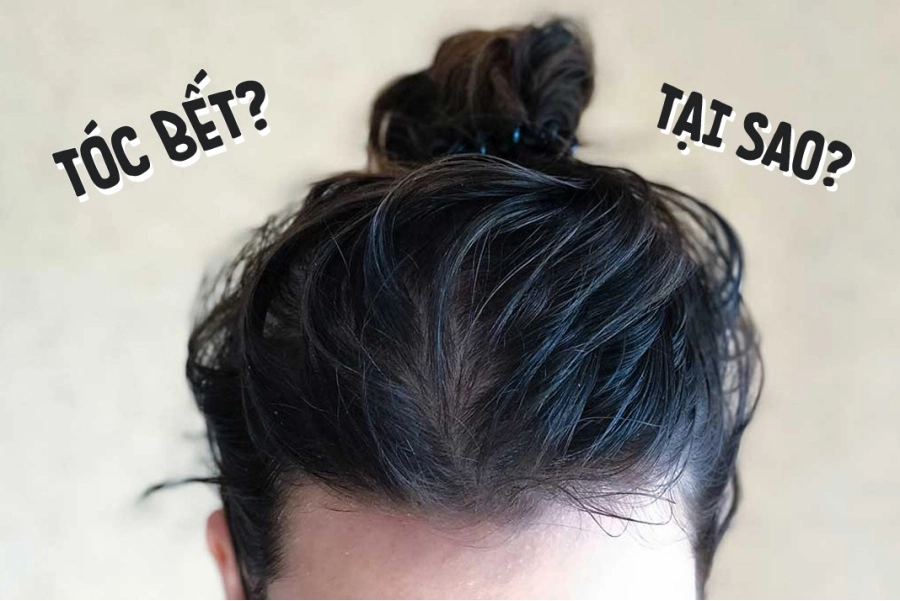 Tết bận lười gội đầu làm 4 mẹo này cầm chân tóc bết 3 ngày vẫn bông tơi - 1