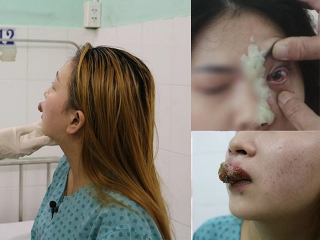 Tết cận kề muốn tậu váy body tập ngay những bài giảm cân thần tốc này - 17