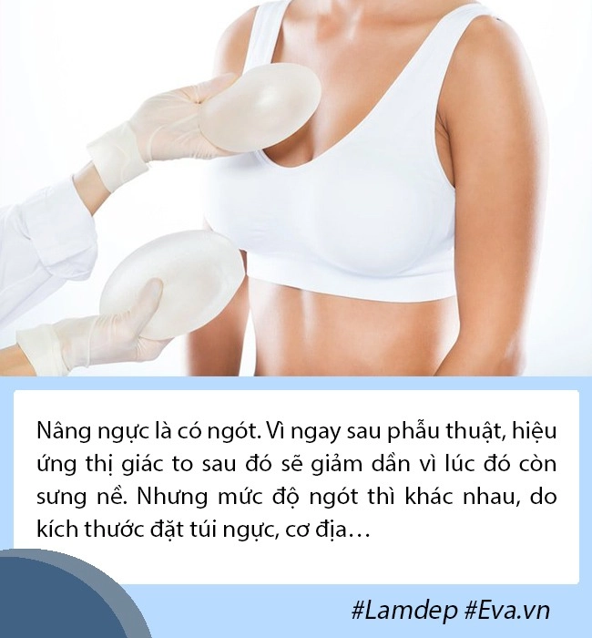 Thắc mắc lớn nâng ngực 1 thời gian có bị nhỏ đi không và bao lâu phải sửa sang lại - 2