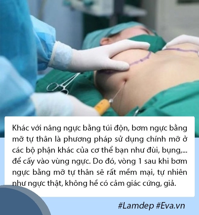 Thắc mắc lớn nâng ngực 1 thời gian có bị nhỏ đi không và bao lâu phải sửa sang lại - 4