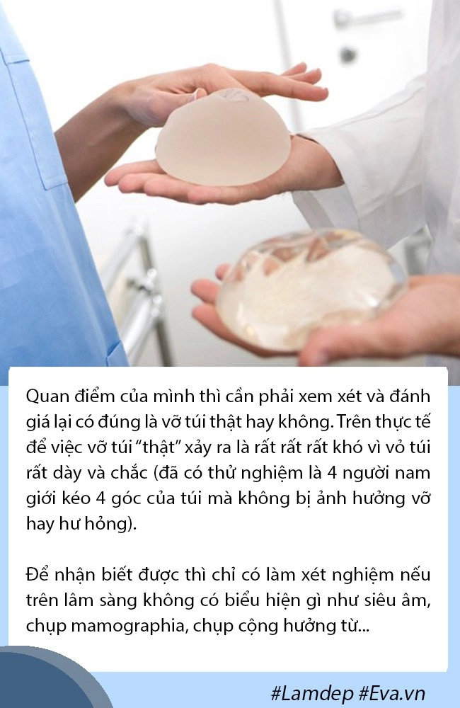 Thắc mắc lớn nâng ngực 1 thời gian có bị nhỏ đi không và bao lâu phải sửa sang lại - 6