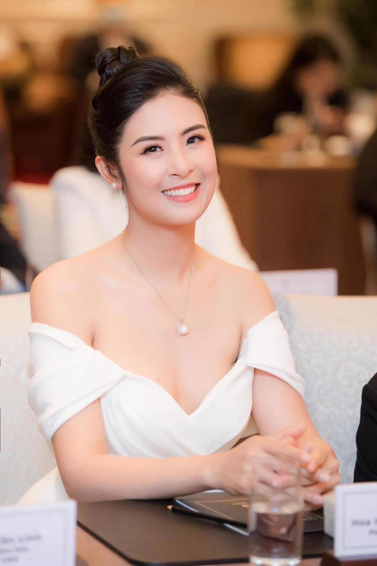 Thẩm mỹ nụ cười được nhiều hoa hậu ứng dụng như thế nào - 2