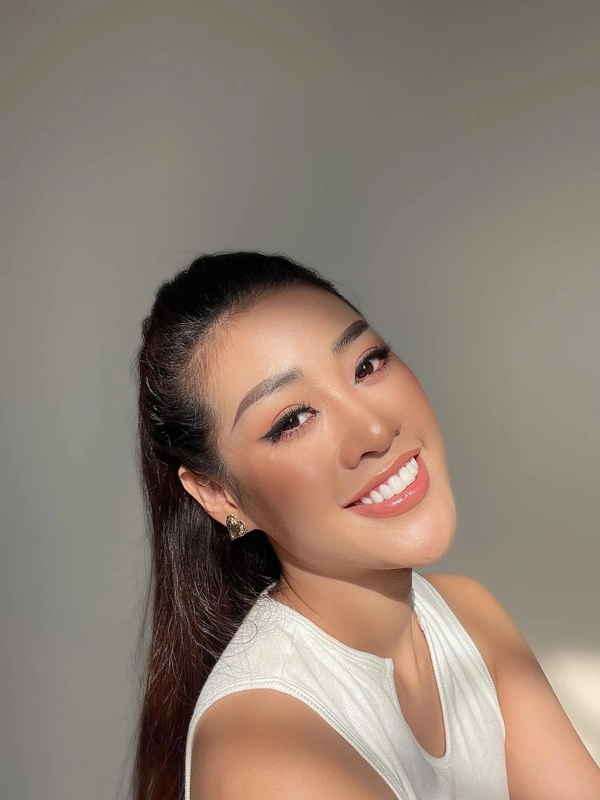 Thẩm mỹ nụ cười được nhiều hoa hậu ứng dụng như thế nào - 4