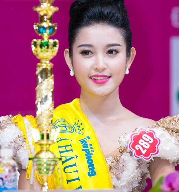 Thẩm mỹ nụ cười được nhiều hoa hậu ứng dụng như thế nào - 13