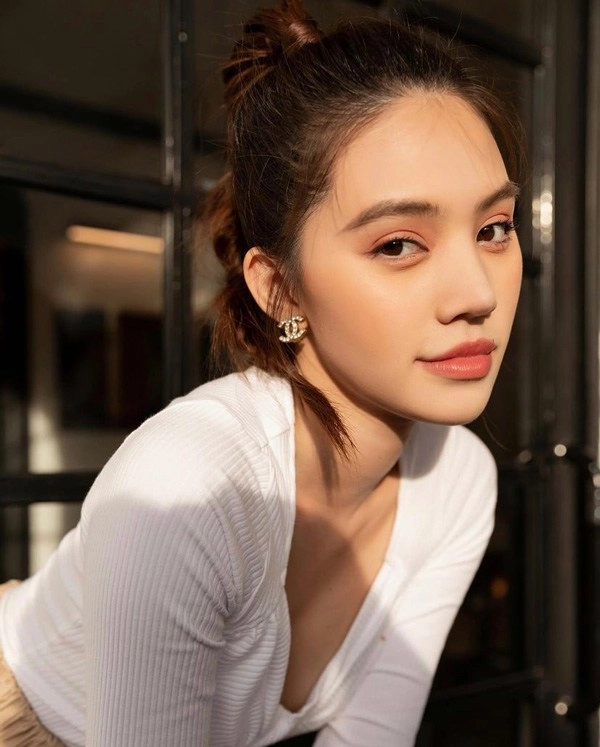 Thẩm mỹ nụ cười được nhiều hoa hậu ứng dụng như thế nào - 20