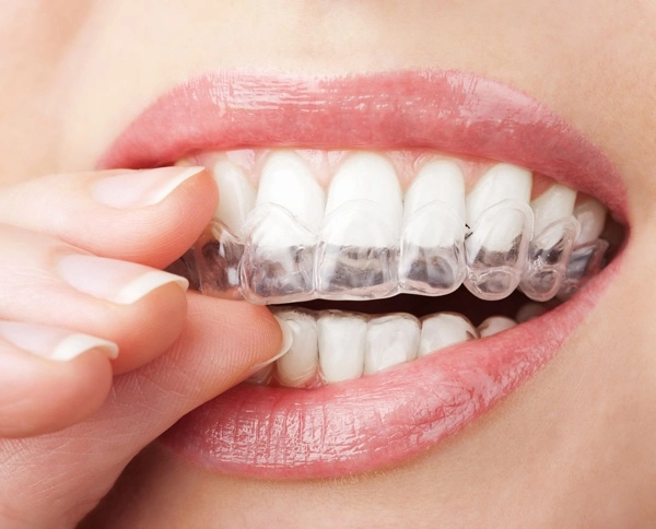Thẩm mỹ nụ cười được nhiều hoa hậu ứng dụng như thế nào - 23