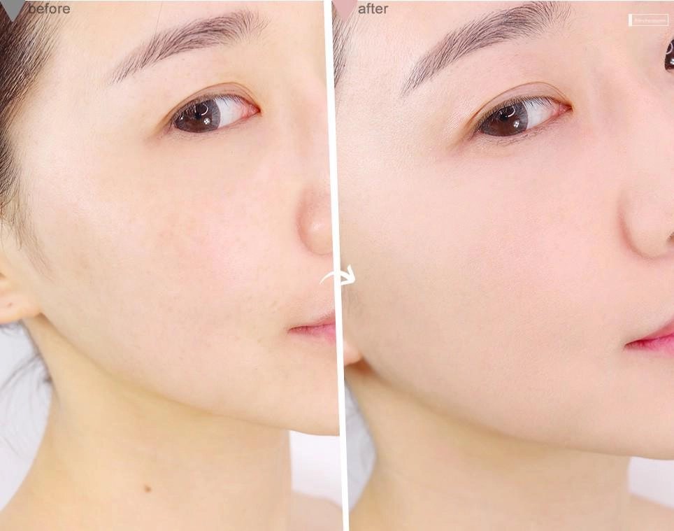 Thời tiết 40-45 độ 4 món mỹ phẩm này cô gái nào cũng phải có nếu không muốn thành than - 4