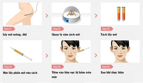 Thu trang tiêm mo lên mat gio tre đep đúng chuan hoa hau làng hài - 15