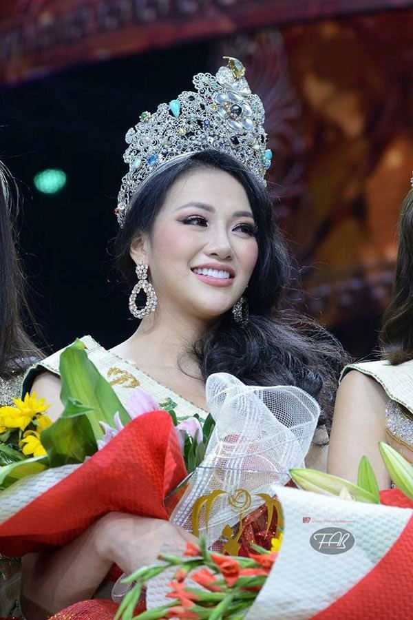 Thừa nhận dao kéo nàng hậu vẫn giành được 1 trong 5 vương miện danh giá nhất hành tinh - 11