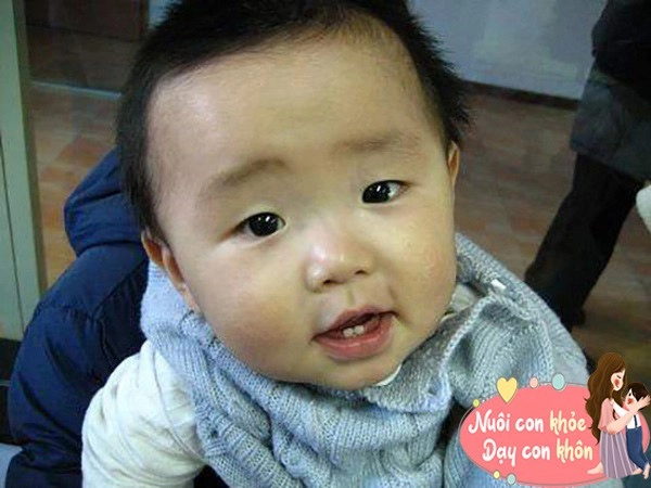 Thực hư chuyện trẻ nổi gân xanh ở mũi sẽ khó nuôi khoa học giải thích - 2