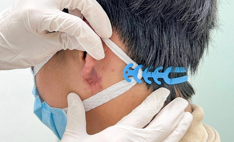 Tiêm tai phật để đổi vận nhiều người đau đớn vì phải phẫu thuật để chữa lành - 4