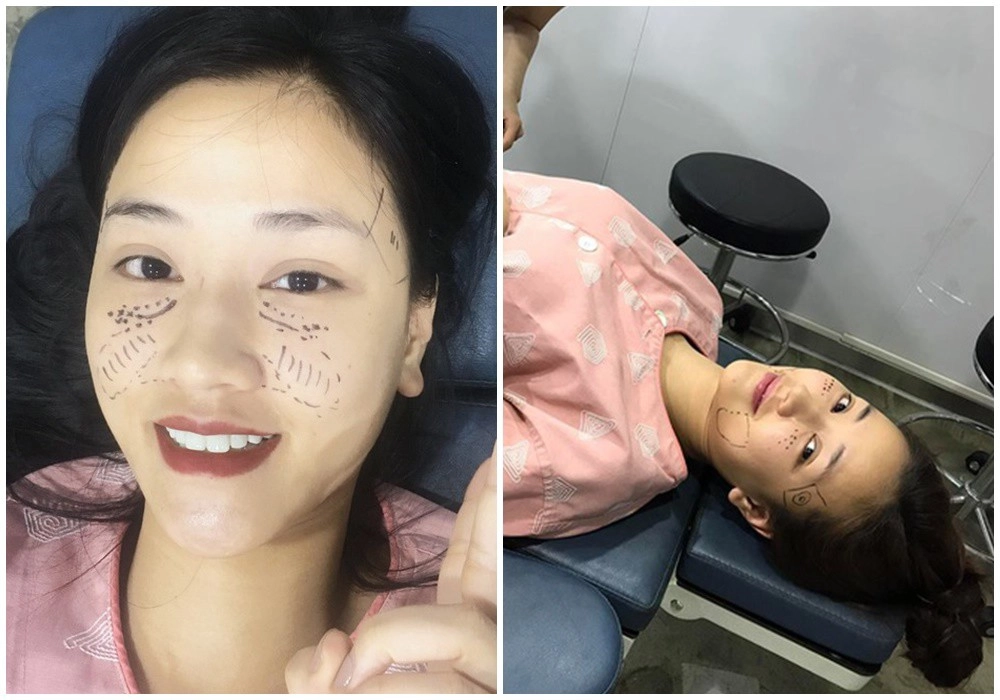 Tiền nào của nấy chi 600 triệu đập mặt nâng cặp tuyết lê sao về nhà đi con đẹp mê - 8